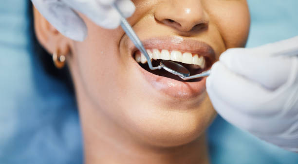 Best After-Hours Emergency Dentist in Kentfield, CA
